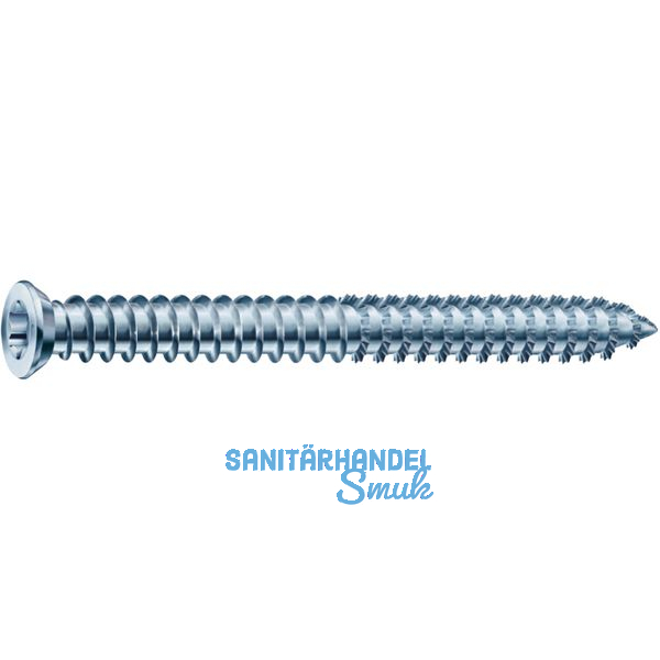 SPAX-RA Rahmenanker 7.5x150 Senkkopf Torx30 verzinkt fr dbellose Verschraubung