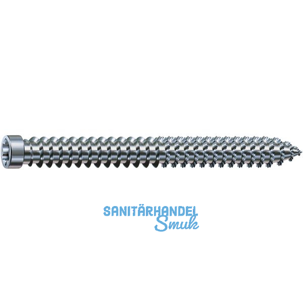 SPAX-RA Rahmenanker 7.5x150 Zylinderkopf Torx30 verzinkt dbellose Verschraubung